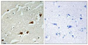 Anti-NF-kB p65 Rabbit Polyclonal Antibody