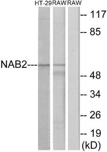 Anti-Nab2 Rabbit Polyclonal Antibody