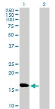 Anti-NPC2 Mouse Polyclonal Antibody