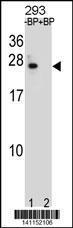 Anti-BCL2 Rabbit Polyclonal Antibody (Biotin)