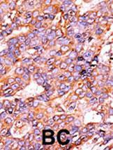 Anti-HIST3H3 Rabbit Polyclonal Antibody (AP (Alkaline Phosphatase))