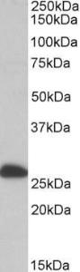 Antibody anti-ETFB A82910-100 100 µg