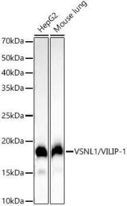 Western blot analysis of extracts of various cell lines, using Anti-VILIP1 Antibody [ARC54754] (A306055) at 1:2,000 dilution