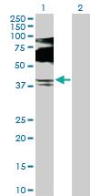 Anti-SQSTM1 Rabbit Polyclonal Antibody