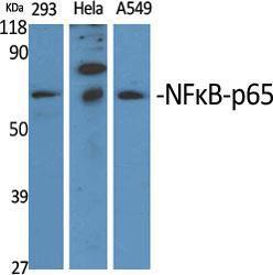 Anti-NF-kB p65 Rabbit Polyclonal Antibody