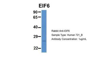 Anti-EIF6 Rabbit Polyclonal Antibody