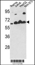 Anti-CALR Rabbit Polyclonal Antibody (PE (Phycoerythrin))