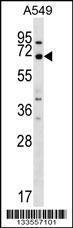 Anti-MEGF9 Rabbit Polyclonal Antibody (FITC (Fluorescein Isothiocyanate))