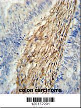 Anti-ELP6 Rabbit Polyclonal Antibody