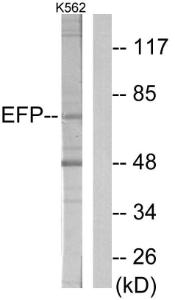 Western blot analysis of lysates from K562 cells using Anti-ZNF147 Antibody. The right hand lane represents a negative control, where the antibody is blocked by the immunising peptide