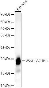 Western blot analysis of extracts of various cell lines, using Anti-VILIP1 Antibody [ARC54754] (A306055) at 1:2,000 dilution