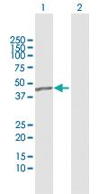 Anti-SEPT1 Rabbit Polyclonal Antibody