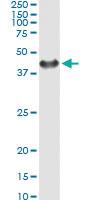 Anti-SGTA Antibody Pair