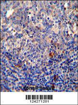 Anti-BCL10 Rabbit Polyclonal Antibody (AP (Alkaline Phosphatase))