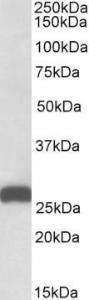 Anti-ETFB Antibody (A82911) (001 µg/ml) staining of Mouse Liver lysate (35 µg protein in RIPA buffer) Primary incubation was 1 hour Detected by chemiluminescence