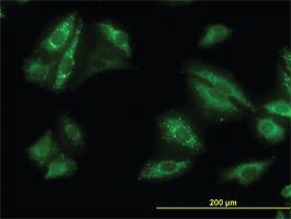 Anti-SQSTM1 Mouse Monoclonal Antibody [clone: 2C11]