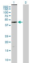 Anti-ZDHHC11 Mouse Polyclonal Antibody