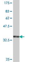 Anti-UCHL1 Mouse Polyclonal Antibody