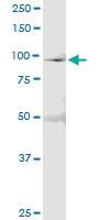 Anti-MCM4 Rabbit Polyclonal Antibody