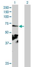 Anti-CEP104 Mouse Polyclonal Antibody