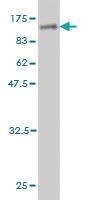 Anti-ZSCAN12 Mouse Monoclonal Antibody [clone: 3E4]