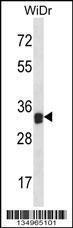 Anti-LGALS9 Rabbit Polyclonal Antibody (HRP (Horseradish Peroxidase))