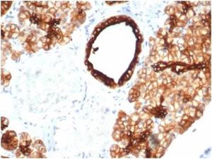 Immunohistochemical analysis of formalin-fixed, paraffin-embedded human salivary gland tissue using Anti-Cytokeratin 7 Antibody [KRT7/4387R]