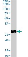 Anti-SDHB Goat Polyclonal Antibody