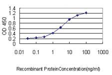 Anti-SQSTM1 Mouse Monoclonal Antibody [clone: 2C11]