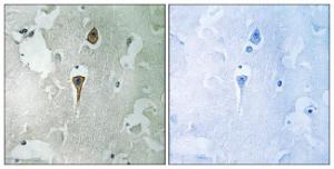 Immunohistochemical analysis of paraffin-embedded human brain tissue using Anti-NMDAR1 Antibody. The right hand panel represents a negative control, where the antibody was pre-incubated with the immunising peptide.