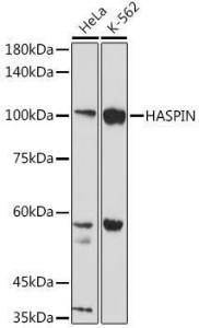 Anti-Haspin antibody