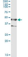 Anti-SEPT1 Mouse Monoclonal Antibody [clone: 1F12]