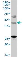 Anti-ZDHHC11 Mouse Polyclonal Antibody