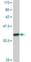 Anti-HR Mouse Polyclonal Antibody