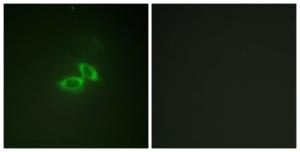 Immunofluorescence analysis of NIH/3T3 cells using Anti-NMDAR1 Antibody. The right hand panel represents a negative control, where the antibody was pre-incubated with the immunising peptide.