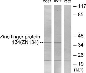 Anti-ZNF134 antibody