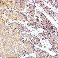 Anti-MAP3K5 Rabbit Polyclonal Antibody