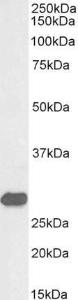 Anti-ETFB antibody