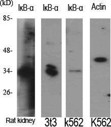 Western blot analysis of various cells using Anti-IkappaB-alpha Antibody