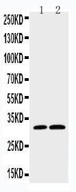 Anti-Caspase-3(P10) Rabbit Polyclonal Antibody