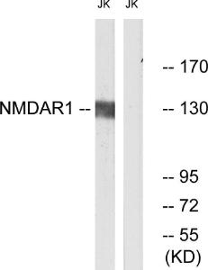 Western blot analysis of lysates from Jurkat cells using Anti-NMDAR1 Antibody. The right hand lane represents a negative control, where the antibody is blocked by the immunising peptide.