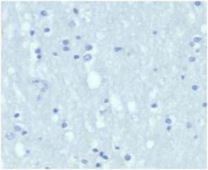 Negative Tissue Control: Immunohistochemical analysis of formalin-fixed, paraffin-embedded human brain using Anti-Cytokeratin 7 Antibody [KRT7/4387R] at 2µg/ml in PBS for 30 minutes at room temperature