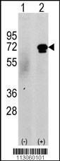 Anti-CAMKK2 Rabbit Polyclonal Antibody (Biotin)