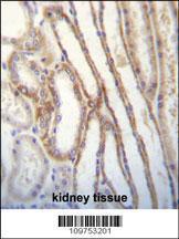 Anti-MYO3B Rabbit Polyclonal Antibody (Biotin)