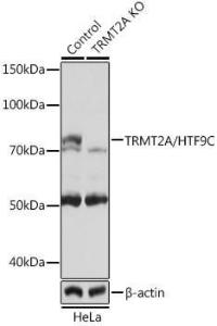 Anti-HTF9C/TRMT2A Rabbit Polyclonal Antibody