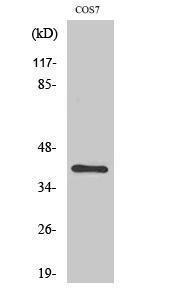 Anti-ZNF134 antibody