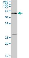 Anti-DKC1 Mouse Polyclonal Antibody