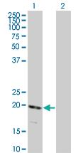 Anti-RNF122 Mouse Monoclonal Antibody [clone: 5E5]