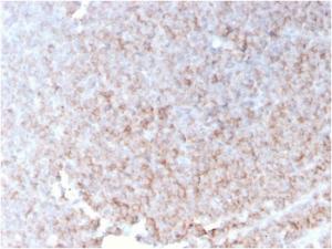 Immunohistochemical analysis of formalin-fixed, paraffin-embedded human spleen using Anti-CD21 Antibody [rCR2/1952]