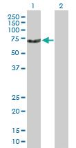 Anti-DKC1 Mouse Polyclonal Antibody